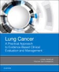 Lung Cancer: A Practical Approach to Evidence-Based Clinical Evaluation and Management- Product Image