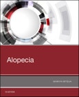 Alopecia- Product Image
