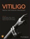 Vitiligo. Medical and Surgical Management. Edition No. 1 - Product Thumbnail Image