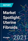 Market Spotlight: Uterine Fibroids- Product Image