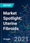 Market Spotlight: Uterine Fibroids - Product Thumbnail Image