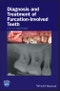 Diagnosis and Treatment of Furcation-Involved Teeth. Edition No. 1 - Product Thumbnail Image