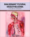 Malignant Pleural Mesothelioma. A Guide for Clinicians- Product Image