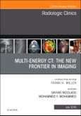 Multi-Energy CT: The New Frontier in Imaging, An Issue of Radiologic Clinics of North America. The Clinics: Radiology Volume 56-4- Product Image