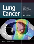 Lung Cancer. Edition No. 4- Product Image