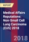 Medical Affairs Reputations: Non-Small Cell Lung Carcinoma (EU5) 2018 - Product Thumbnail Image
