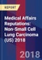 Medical Affairs Reputations: Non-Small Cell Lung Carcinoma (US) 2018 - Product Thumbnail Image