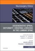 Degenerative Spinal Deformity: Creating Lordosis in the Lumbar Spine, An Issue of Neurosurgery Clinics of North America. The Clinics: Surgery Volume 29-3- Product Image