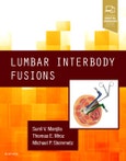 Lumbar Interbody Fusions- Product Image