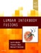 Lumbar Interbody Fusions - Product Thumbnail Image