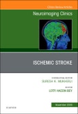 Ischemic Stroke, An Issue of Neuroimaging Clinics of North America. The Clinics: Radiology Volume 28-4- Product Image