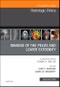 Imaging of the Pelvis and Lower Extremity, An Issue of Radiologic Clinics of North America. The Clinics: Radiology Volume 56-6 - Product Thumbnail Image