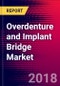 Overdenture and Implant Bridge Market | EU | Units Sold, Average Selling Prices, Market Values, Shares, Product Pipeline, Forecasts, SWOT | 2018-2024 | MedSuite - Product Thumbnail Image