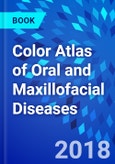 Color Atlas of Oral and Maxillofacial Diseases- Product Image