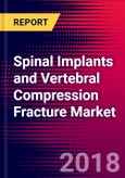 Spinal Implants and Vertebral Compression Fracture Market | Japan | Units Sold, Average Selling Prices, Market Values, Shares, Product Pipeline, Forecasts, SWOT | 2018-2024 |- Product Image