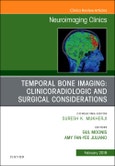 Temporal Bone Imaging: Clinicoradiologic and Surgical Considerations, An Issue of Neuroimaging Clinics of North America. The Clinics: Radiology Volume 29-1- Product Image