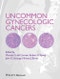 Uncommon Gynecologic Cancers. Edition No. 1 - Product Image