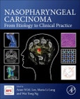 Nasopharyngeal Carcinoma. From Etiology to Clinical Practice- Product Image