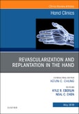 Revascularization and Replantation in the Hand, An Issue of Hand Clinics. The Clinics: Orthopedics Volume 35-2- Product Image