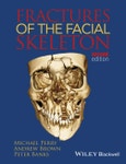 Fractures of the Facial Skeleton. Edition No. 2- Product Image