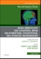 Brain Embryology and the Cause of Congenital Malformations, An Issue of Neuroimaging Clinics of North America. The Clinics: Radiology Volume 29-3 - Product Image