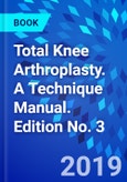 Total Knee Arthroplasty. A Technique Manual. Edition No. 3- Product Image