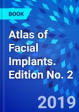 Atlas of Facial Implants. Edition No. 2- Product Image