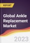 Technology Landscape, Trends and Opportunities in the Global Ankle Replacement Market - Product Image